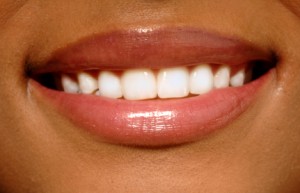 Can Bleaching or Whitening weaken Teeth?