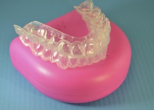 Plastic braces to straighten teeth