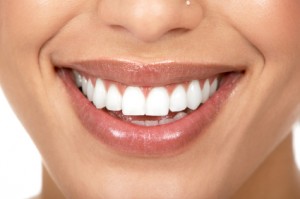 Invisalign