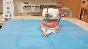 Dentures Catonsville Dental Care