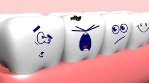 Solutions for Overcrowded Teeth