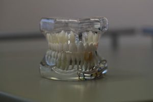 Dentures Catonsville Dental Care