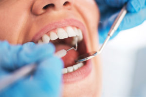 How to Keep Your Gums Healthy Catonsville Dental Care