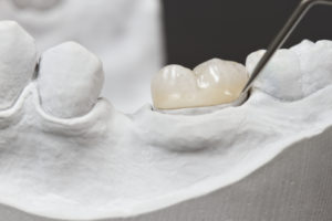 Crowns in Elkridge, MD Catonsville Dental Care