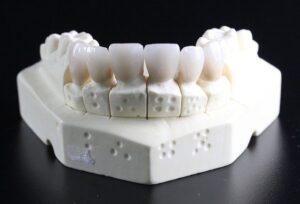 Partial and Complete Aesthetic Dentures in Columbia, MD 