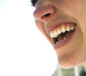 Get A Beautiful Smile With Invisalign in Ferndale