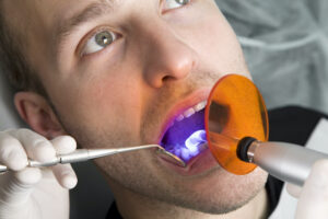 How Lasers Are Changing Dentistry