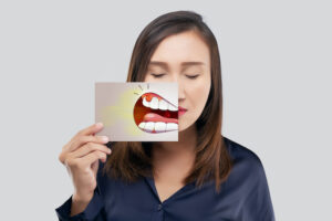 Some Unexpected Signs of Gum Disease