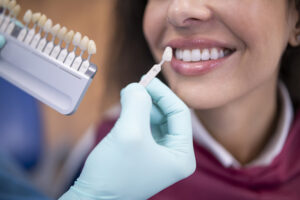 The Best Methods for Teeth Whitening 