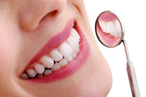 Essential Facts About Teeth Whitening 